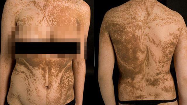 İnsan vücudundaki gizli çizgilerin sırrı! Görebilmek için sadece tek bir yol var