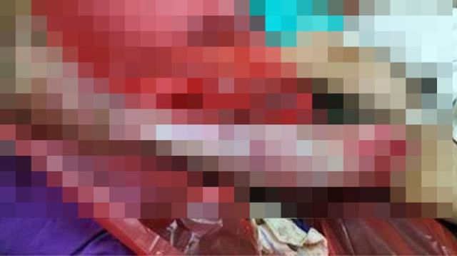 Dünyayı gezen adam, önceki sabah kalkıp sol bacağına baktığında sadece kemiğinin kaldığını gördü