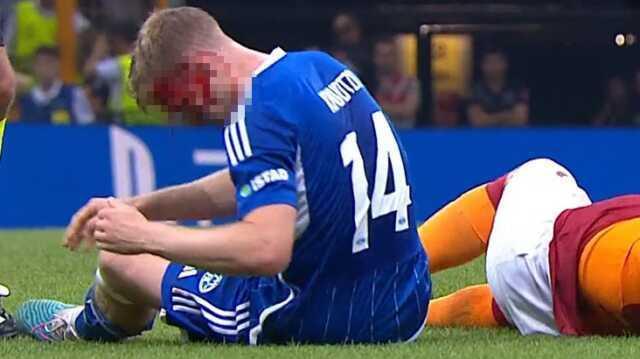 Yürekler ağza geldi! Icardi'yi durdurmaya çalışan iki oyuncu çarpıştı birinin kafası yarıldı