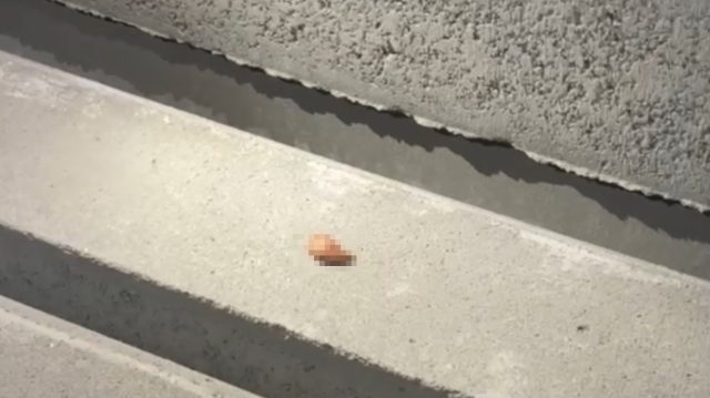 Mersin'de kazada, sürücünün parmağı koptu: Dakikalarca aradılar