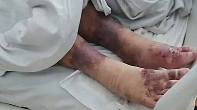 Ailesi 15 yaşındayken 'kayıp' diyerek eve hapsetti, 27 yıl sonra kurtarıldı