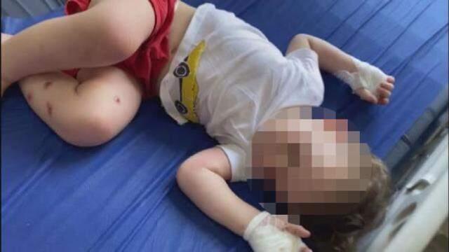 1,5 yaşındaki bebeğine işkence yaptığı iddia edilen babaya meydan dayağı