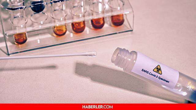 Covid test sonucu ne zaman çıkar? Korona testi ne zaman belli oldur?