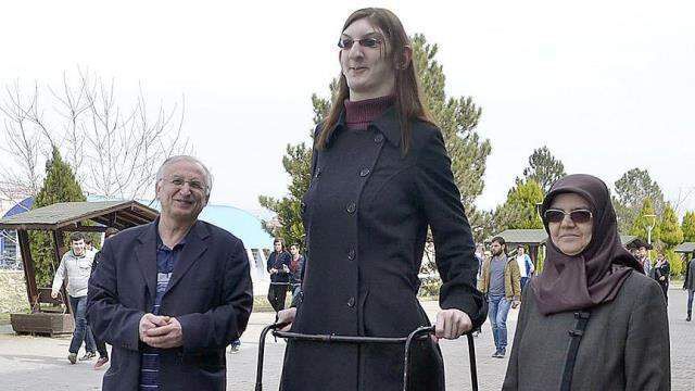 Rümeysa Gelgi kimdir? Rümeysa Gelgi boyu kaç, hastalığı nedir?