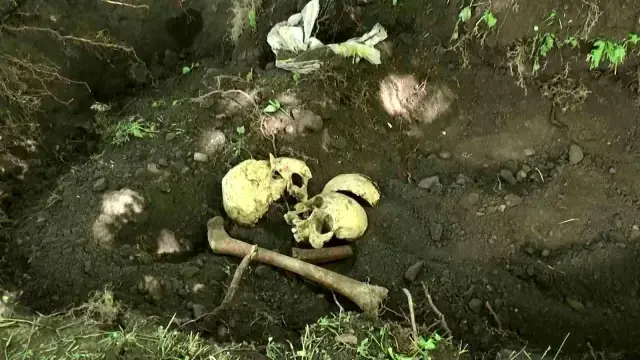 Su patlağı için yapılan kazıda insan kafatası bulundu, haberi alan polis ekipleri harekete geçti