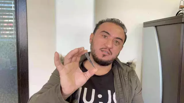 Elinin ağrısı yüzünden hastaneye giden vatandaşın röntgen sonucu ilginç gerçeği ortaya çıkardı