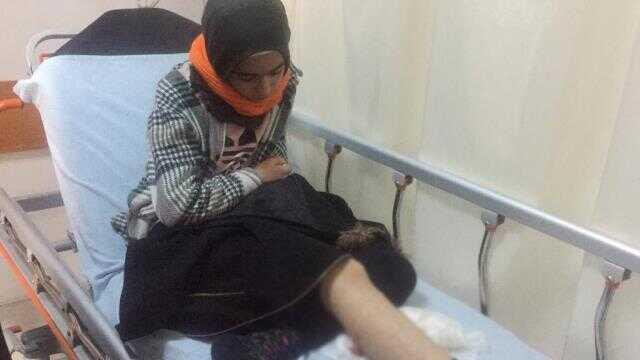 Kars'ta sokak köpekleri, okula giden küçük kıza saldırdı