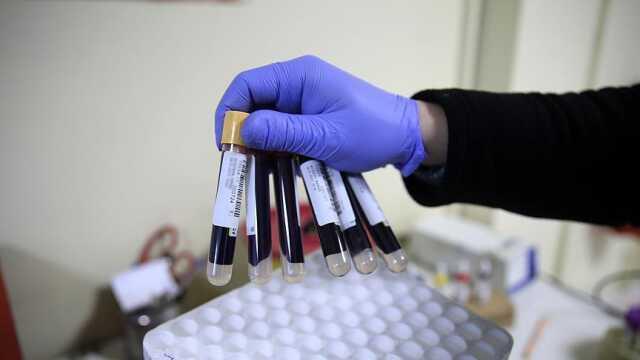 Demir eksikliği neden olur? Demir eksikliğine ne iyi gelir? Demir eksikliği belirtileri neler? Demir eksikliği anemisi nedir, belirtileri nelerdir?