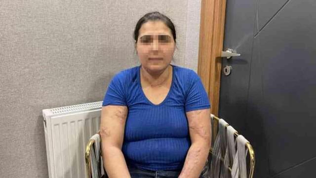 Eşi ve kayınpederi, genç kadının üzerine ütü basıp kolonyayla yakmaya çalıştı