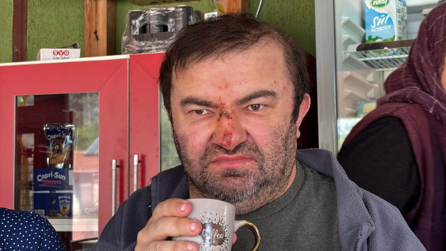 Bolu'da Engelli Birey Darp Edildi