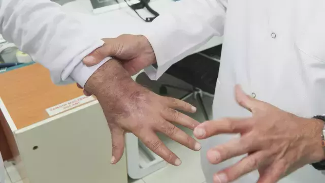 Doktorlar bile şaşırdı! Hırsız elini öyle bir ısırdı ki vaka literatüre girmeye hazırlanıyor