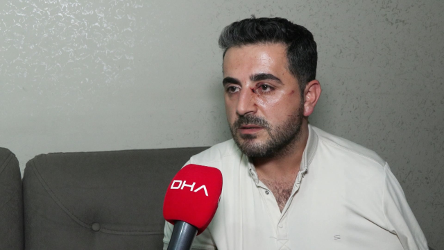 Esenyurt'ta eski kiracı ev sahibini bıçakla yaraladı^