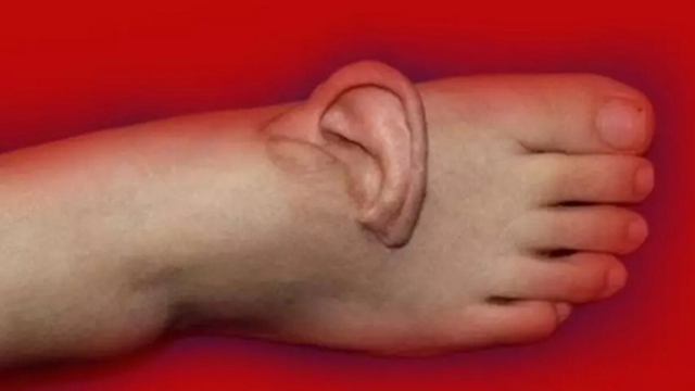 Eşi benzeri olmayan olay! Kulağını 5 ay ayağında taşıdı