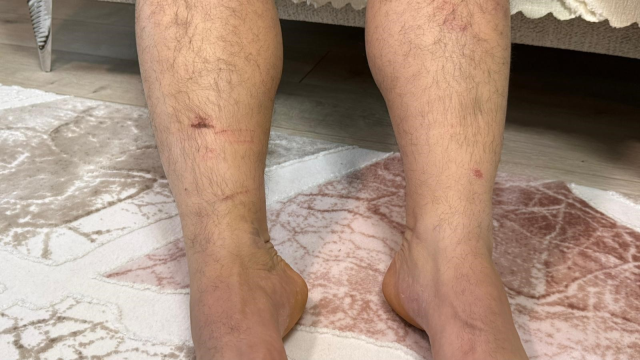 Diyarbakır'da bir şahıs, kuzenlerini icraya verdiği gerekçesiyle kaçırıldığını iddia etti: Anlatılanlar kan dondurdu