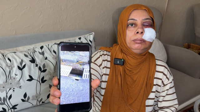 Akraba ziyaretine giderken bu hale geldi