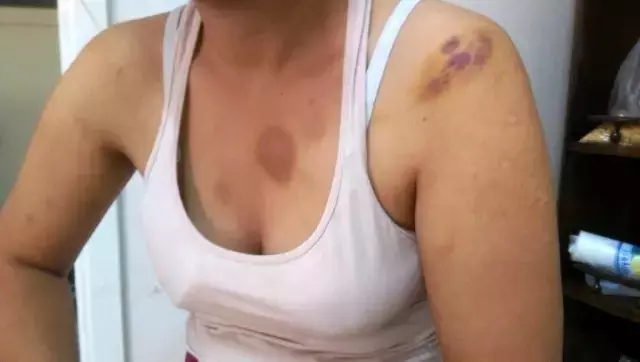 Öz annesi tarafından parayla satıldı, eşinden şiddet gördü! Saime'den yardım çığlığı