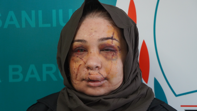 Polis eşi tarafından darbedildiği iddiasıyla şikayetçi oldu