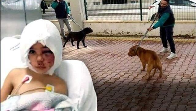 Cumhurbaşkanı Erdoğan, pitbull saldırısına uğrayan Asiye üzerinden köpek sahiplerine sert çıktı: Beyaz Türkler, sahip çıkın hayvanlarınıza