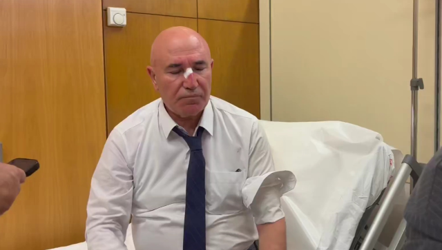 Meclis'teki kavgada Mahmut Tanal'ın burnu kanadı