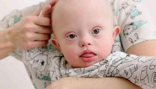 Doğum kusurlarının nedenleri nelerdir ve nasıl önlenir?