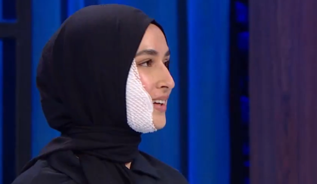 MasterChef Beyza yüzünde iz kalacak mı, son hali nasıl?