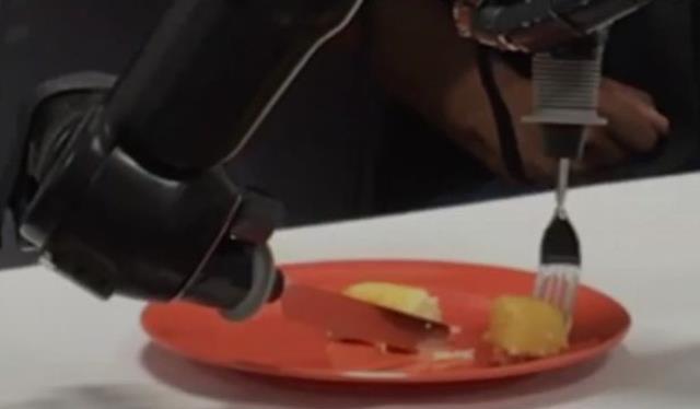 Dünya bu anları hayretle izledi! Felçli adamın beynine makine bağlandı, sonrasında olanlar doktorları bile şaşırttı