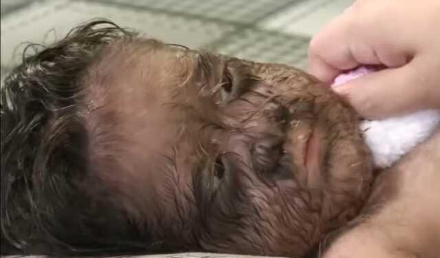 Malezya Kralı ve Kraliçesi kurt adam sendromu olan 2 yaşındaki kızı 'cennetten gelen çocuk' olarak nitelendirdi