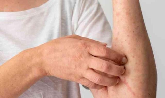 ZONA NEDEN OLUR? Zona (GECE YANIĞI) nedir, belirtileri neler?