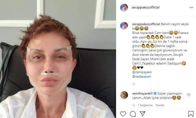 Estetik ameliyatı için Seda Sayan'ın aracı olduğu Serap Paköz son halini paylaştı