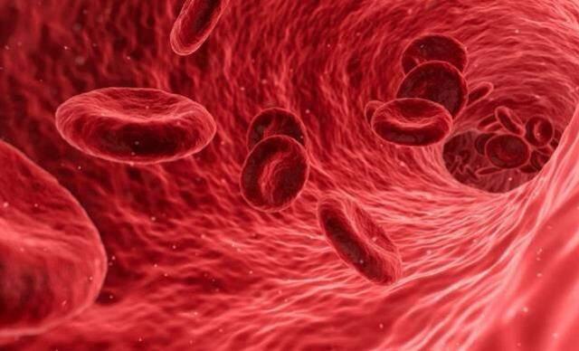 MCV nedir? MCV kaç olmalıdır? MCV yüksekliği, MCV düşüklüğü ne demektir? Nasıl tedavi edilir?