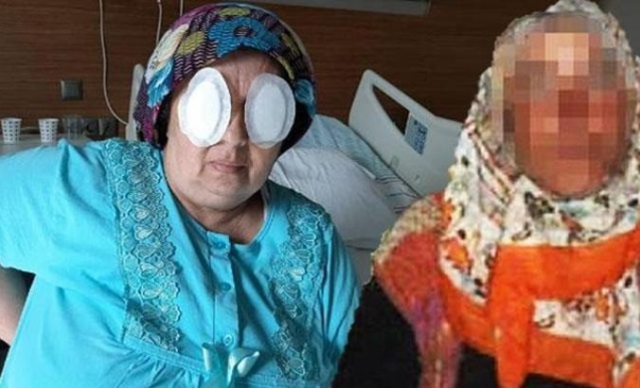 Şizofreni hastası, yatalak hastanın gözlerini oydu! İlk vukuatı değil