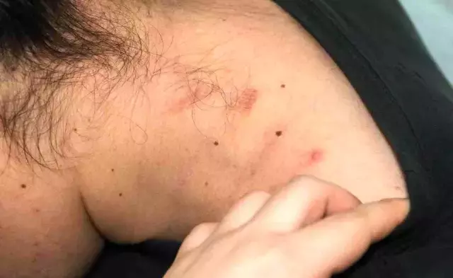 Oğlunun gözü önünde dayak yedi, her yeri mosmor oldu! Arkasındaki neden akıllara zarar