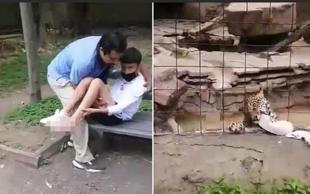 Fotoğraf çekmek jaguar kafesine atlayan çocuğun ayağı parçalandı