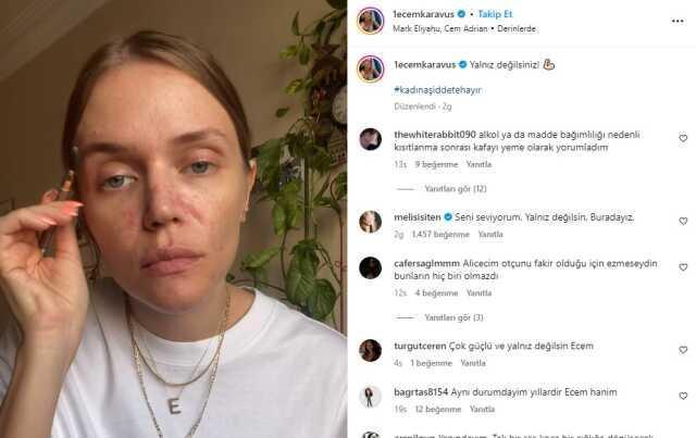 Ecem Karavus ailesi kimdir, kaç yaşında, nereli? Ecem Karavus olayı nedir, ne zaman oldu, ne zaman başladı?