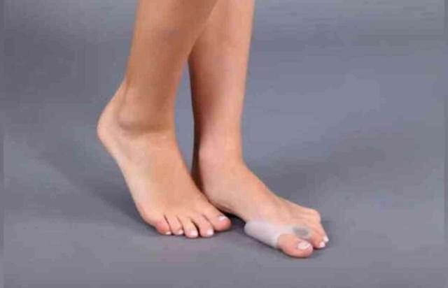 Ayak başparmak çıkıntısı Bunyon-Halluks Valgus nedir? Bunyon nasıl düzelir?