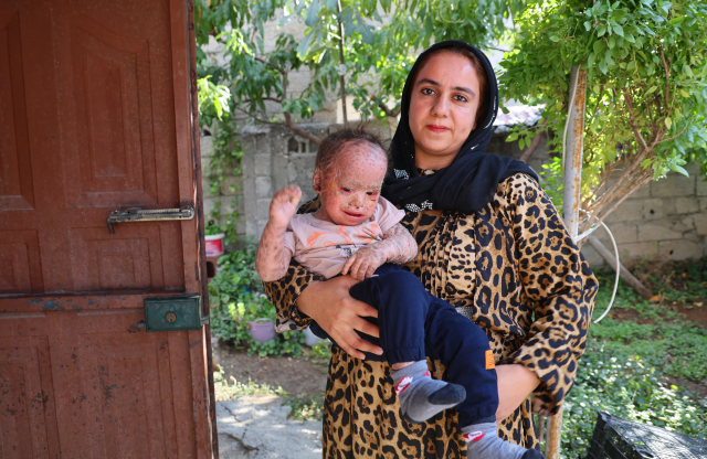 Hastalıkla savaşan Yusuf'un fotoğraflarını çalıp dolandırıcılık yaptılar