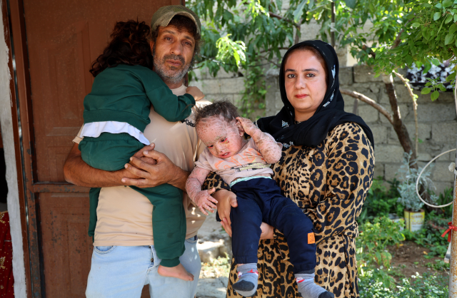 Hastalıkla savaşan Yusuf'un fotoğraflarını çalıp dolandırıcılık yaptılar