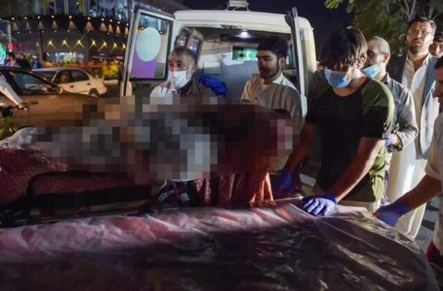 Son Dakika: Afganistan'ın başkenti Kabil'de 3 bombalı saldırı: 60 ölü, 140 yaralı