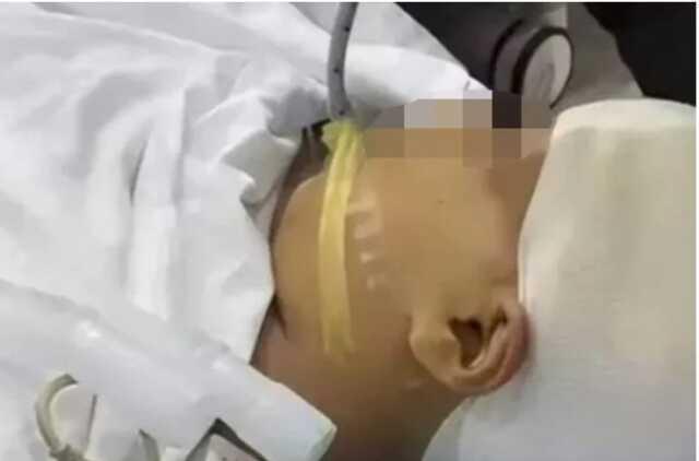 Öğretmen 9 yaşındaki öğrencisinin kafasına metal cetvelle vurarak kafatasını parçaldı