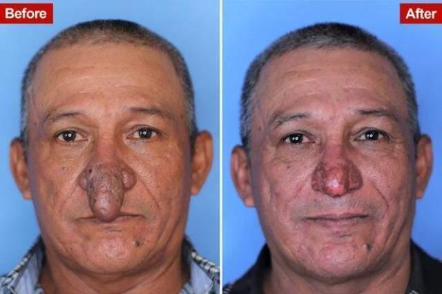 Burnu cinsel organa benzeyen adam, sosyal medyada gündeme oturdu