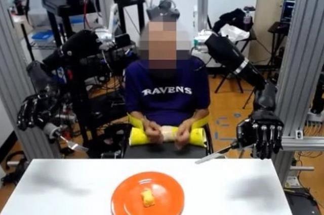 Dünya bu anları hayretle izledi! Felçli adamın beynine makine bağlandı, sonrasında olanlar doktorları bile şaşırttı