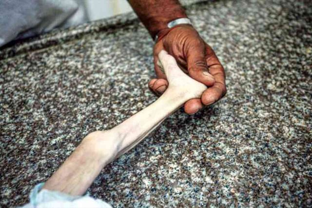 Gazze'de bir bebek daha açlık yüzünden can verdi