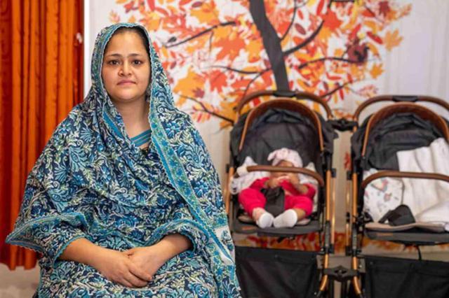 Cumhurbaşkanı Erdoğan'ın Talimatıyla Yapışık İkizler Ayrıldı