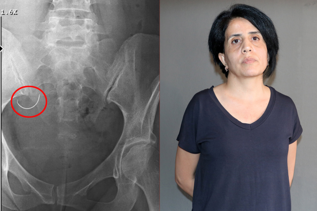 Bebek Sahibi Olamayan Kadın, Eşinden Şiddet Gördüğü İddiasıyla Boşandı