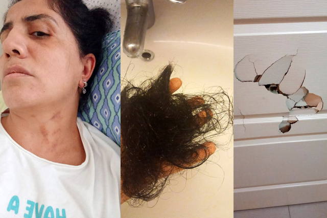 Bebek Sahibi Olamayan Kadın, Eşinden Şiddet Gördüğü İddiasıyla Boşandı