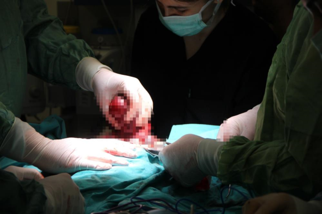 Dünyada yedinci vaka! Eymen bebek tıp literatürüne girdi