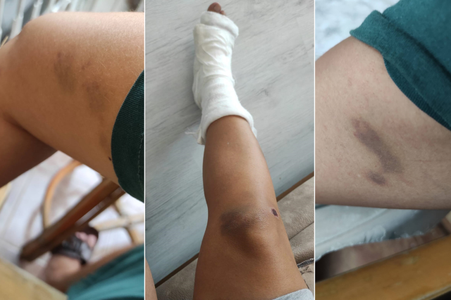 Burcu öğretmenin yardım çığlığı: Kurtarın beni