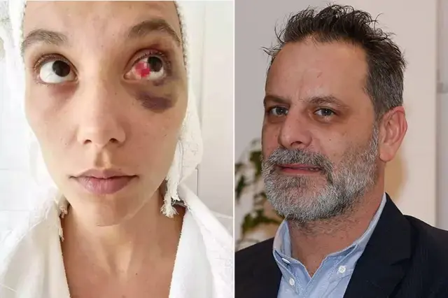 Ozan Güven'e 'kasten yaralama' suçundan hapis cezası