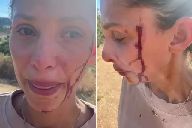 Can Yaman'ın sevgilisi Sara Bluma şiddet gördüğünü açıkladı