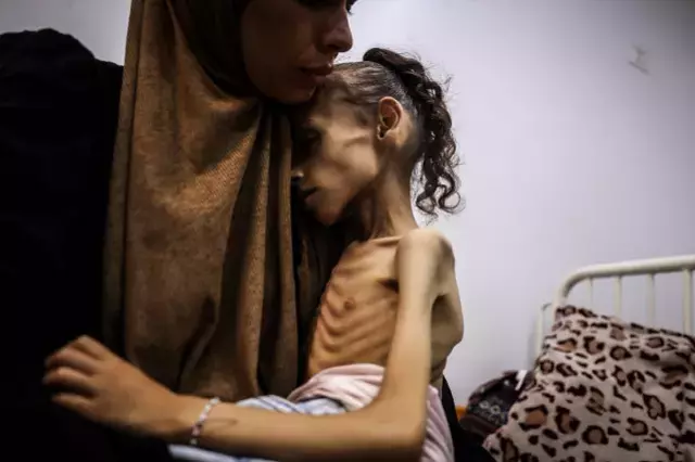 İnsanlığı utandıracak görüntüler! Gazzeli Meryem yavaş yavaş ölüyor